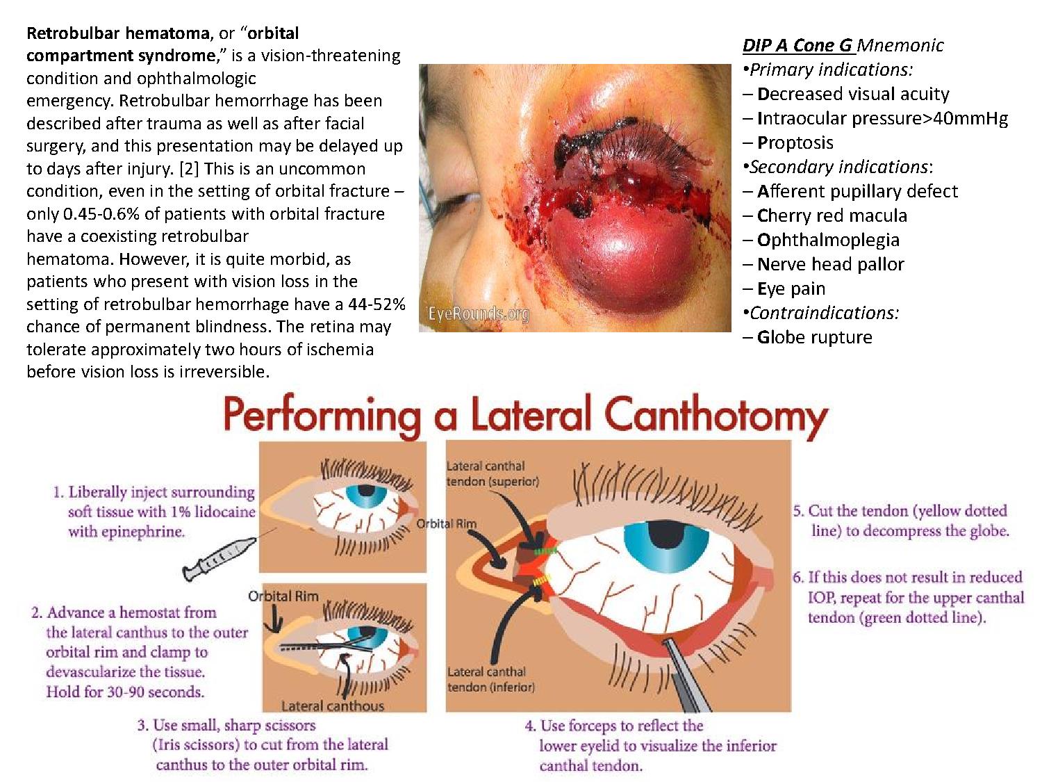 Handout Occular Injury Retrobulbar Hematoma and Lateral Canthotomy