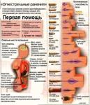 Балистика огнестрельные ранения