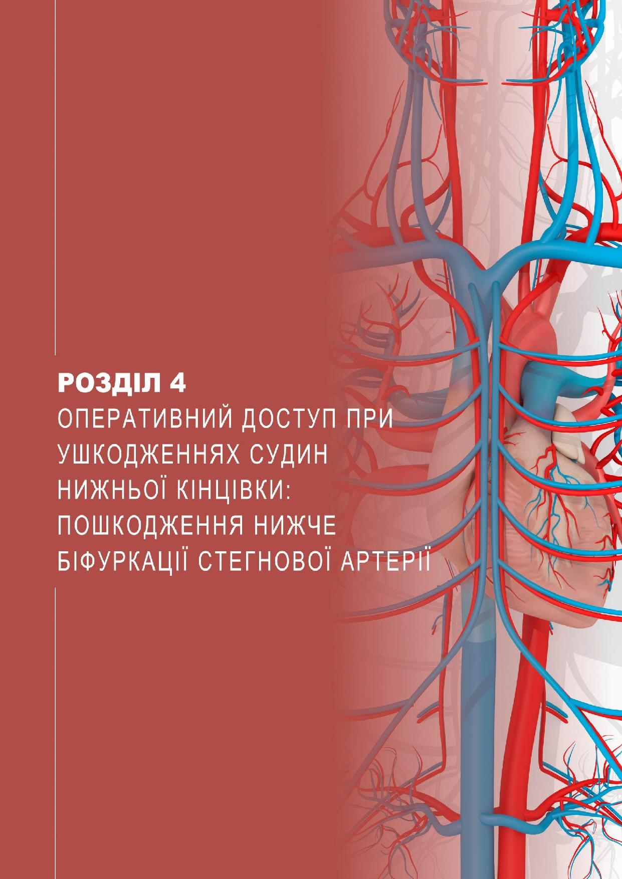Оперативний доступ при ушкодженнях судин нижньої кінцівки: пошкодження нижче біфуркації стегнової артерії