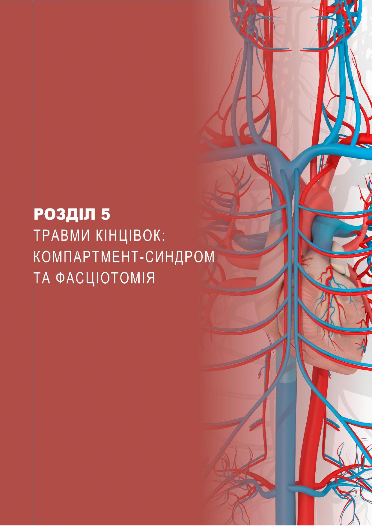 Травми кінцівок: компартмент-синдром та фасціотомія