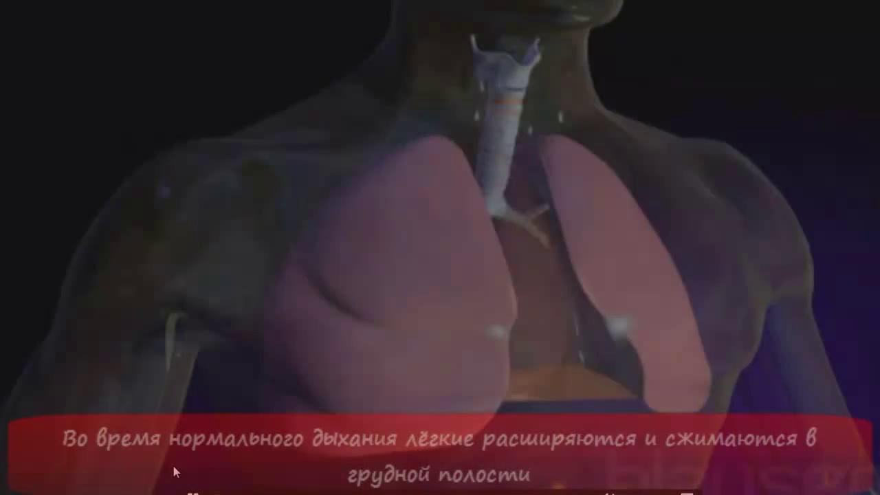 Учебный Фильм Пневмоторакс